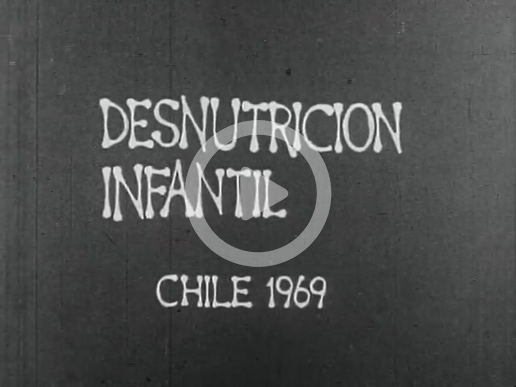 Desnutricion-Infantil